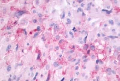 Immunohistochemistry: Melatonin Receptor 1B Antibody [NBP3-14401]